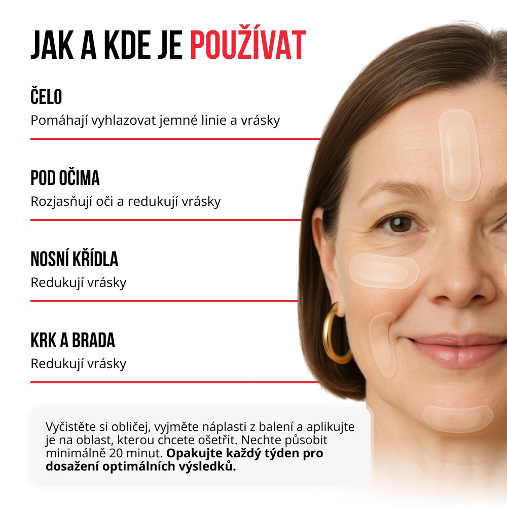 Samorozpustné mikrojehličkové náplasti